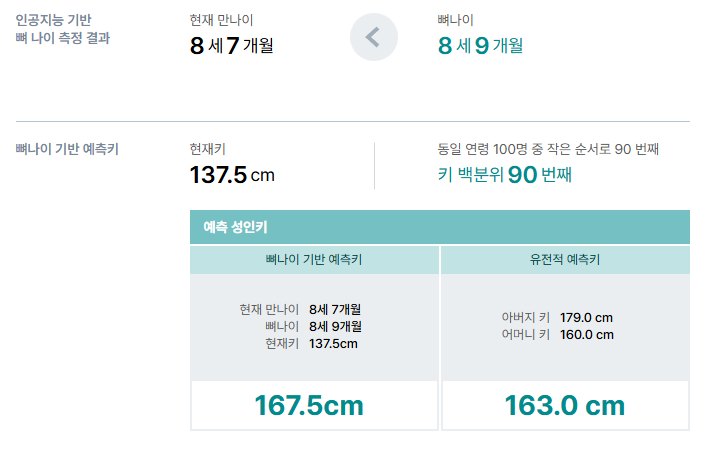 VUNO AI 뼈나이 검사 결과 예시