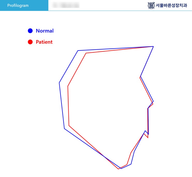 교정 분석 프로필 그래프 - 환자와 평균 비교