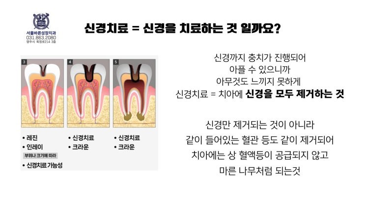 신경치료는 치아 신경을 모두 제거하는 치료라는 설명